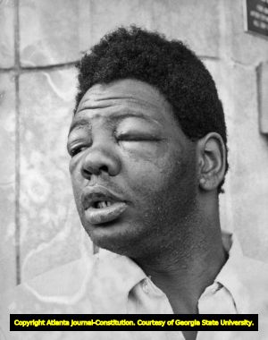 Henry Campbell accuses Atlanta Police of brutality, 1969
